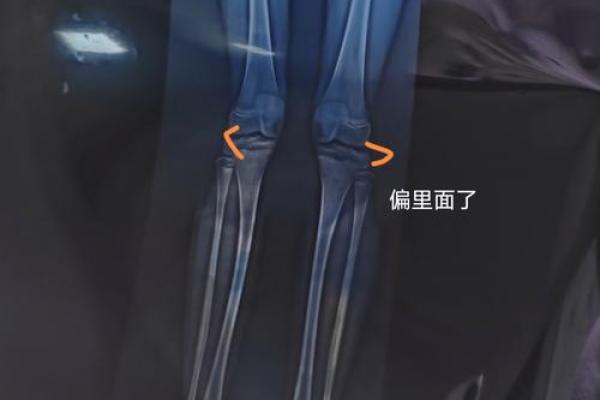 反而错了？腿长在命理中的作用被误解的真相