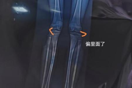 反而错了？腿长在命理中的作用被误解的真相